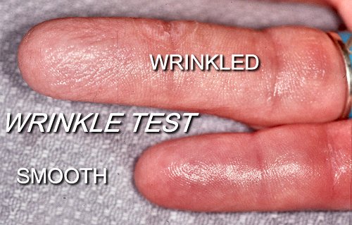 wrinkle test