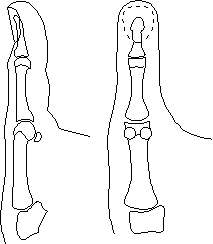 Go to the Thumb Bones Page